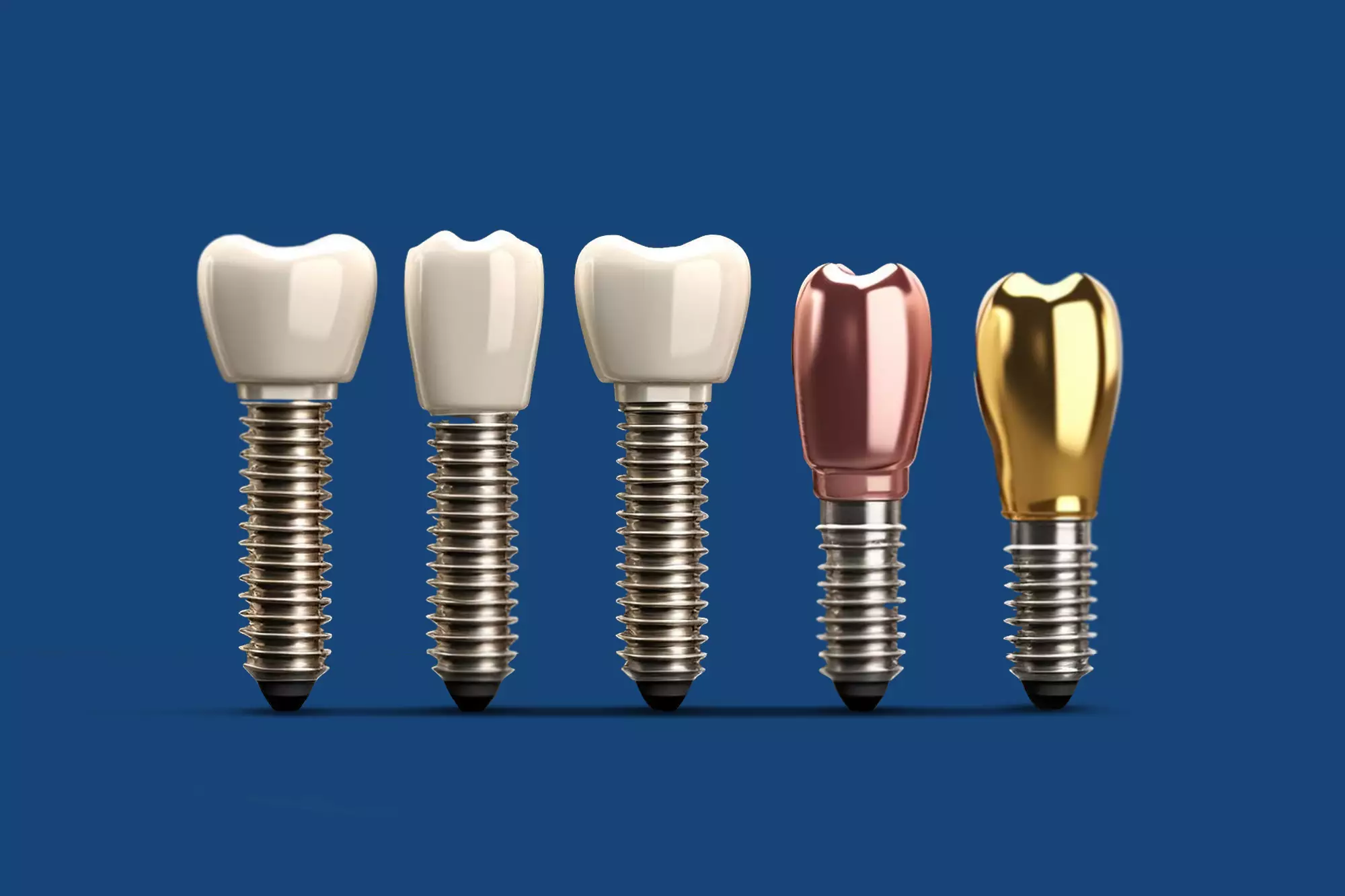 Implante dentário: conheça todos os tipos e qual é o ideal para você